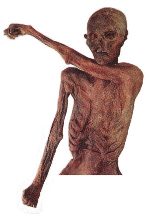 "Ötzi"  The Iceman