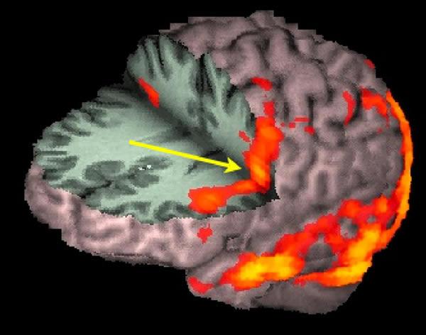 Brain scan during SuperBowl ad.