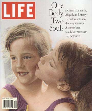 Hensel Twins, cover of Life Magazine