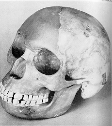 Piltdown Skull