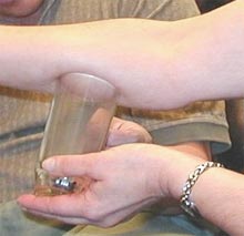Cupping